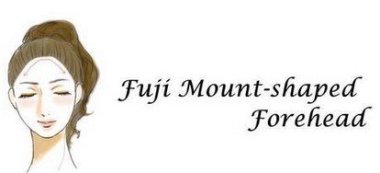 髪の生え際で性格判断 あなたはどのタイプ