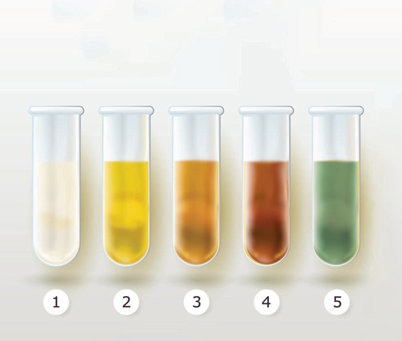 抗生 物質 尿 の 色