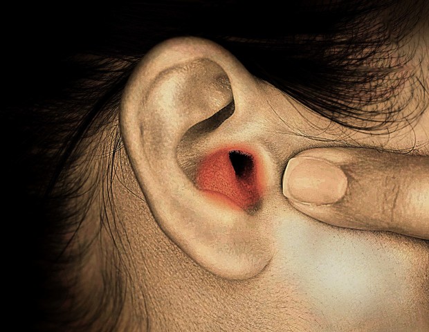 女性の耳の痛み 原因は耳に住み着いたクモだった