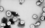 中国共産党ウイルス（SARS-CoV-2）（CDC/Getty Images）