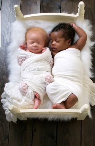 超希少 黒人とアルビノの双子を出産したフォトグラファーの母親が写真に込める思い