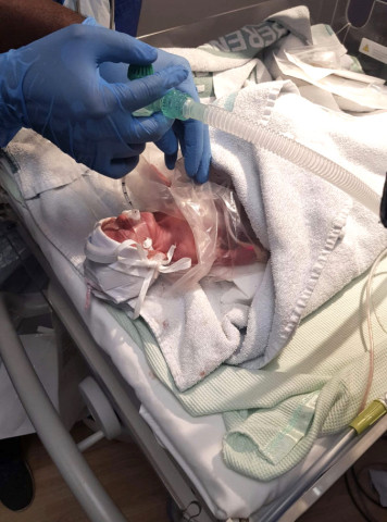 妊娠25週目で生まれた女の子の赤ちゃん 無事退院 大紀元 エポックタイムズ