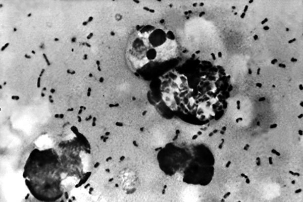 腺ペスト菌の画像（Shutterstock）