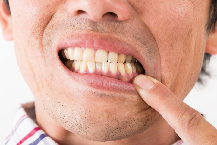 ( freeangle / PIXTA)