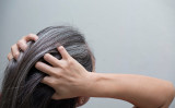 年齢のわりに白髪が早く現れる人、頭皮の脂が多い人、ぬけ毛に悩む人が多くなっています。（Shutterstock）